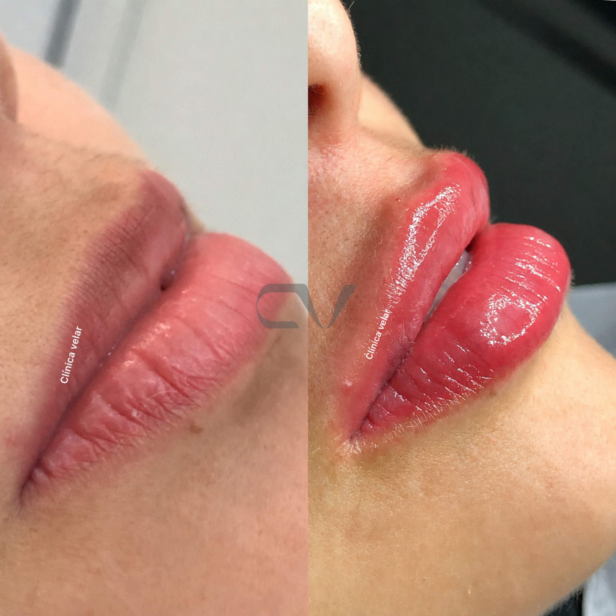 Uma Boca é Uma Boca - Caso Real 1