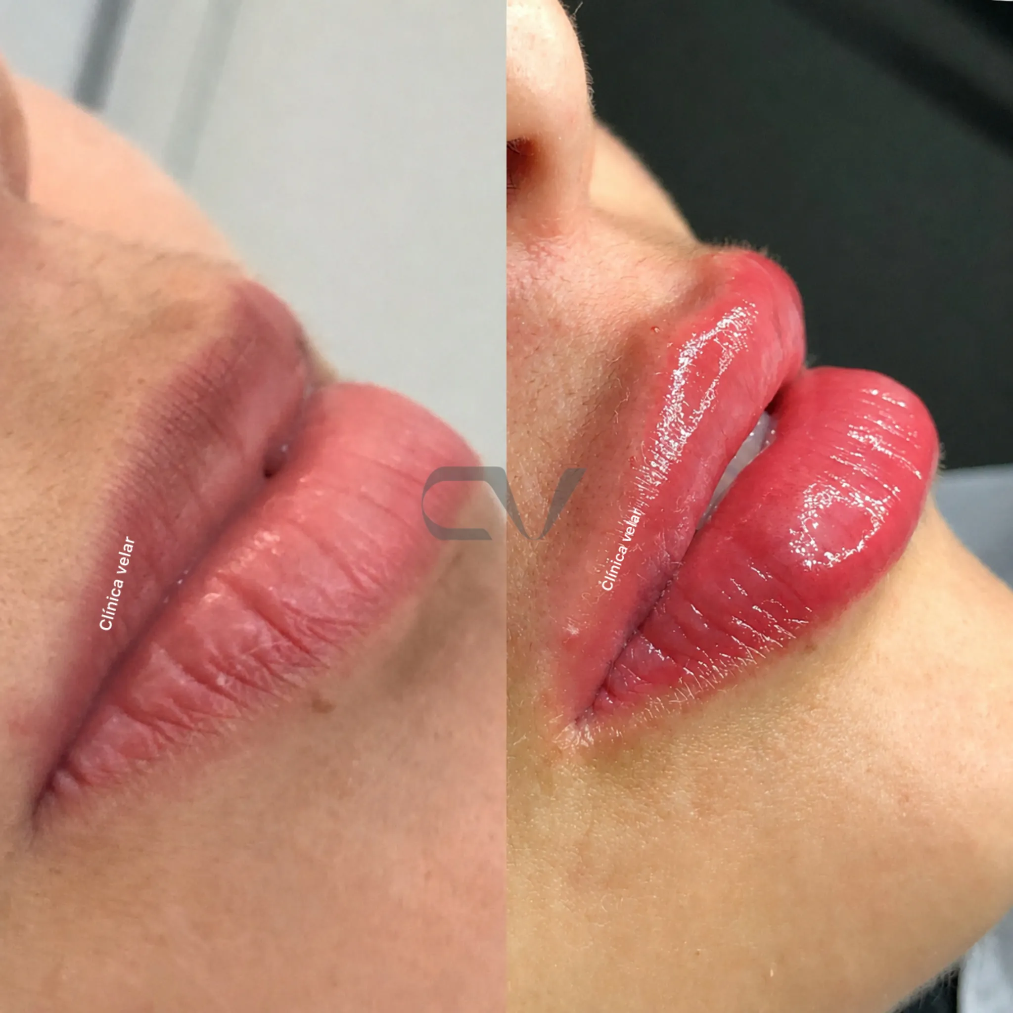 Uma Boca é Uma Boca - resultado real 1